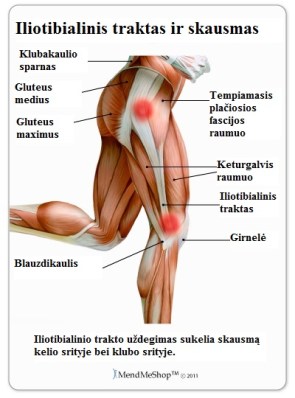 iliotibial-band-syndrome
