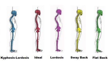spine-alignments